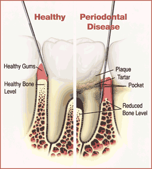 Tooth Diagram