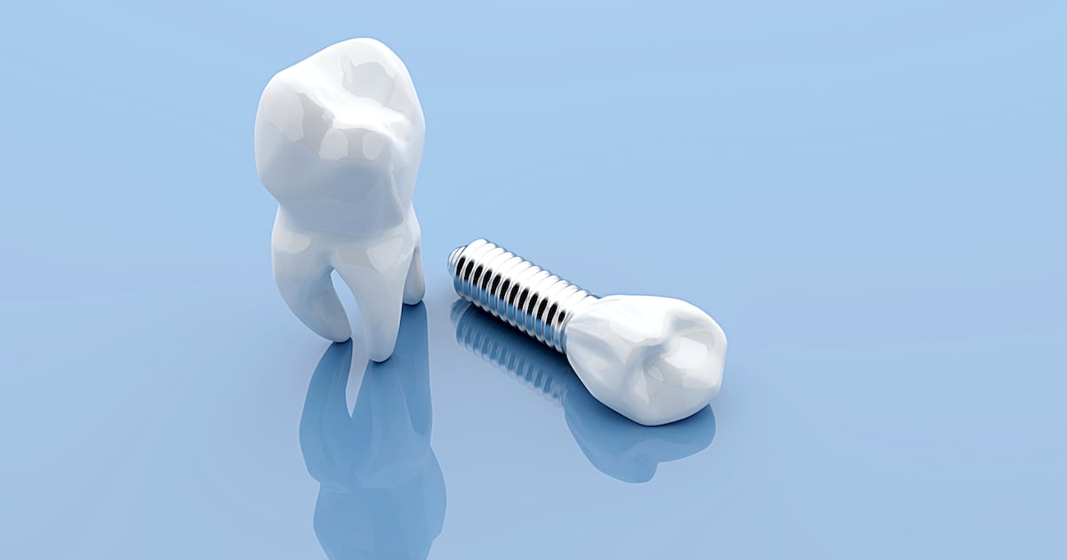 Dental implant and teeth, isolated on blue medical background