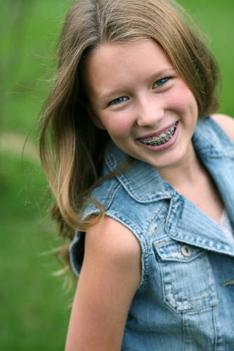What Types of Braces Are Available?